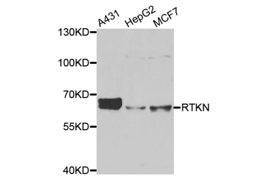 Anti-RTKN Antibody from Bioworld Technology (BS8392) - Antibodies.com