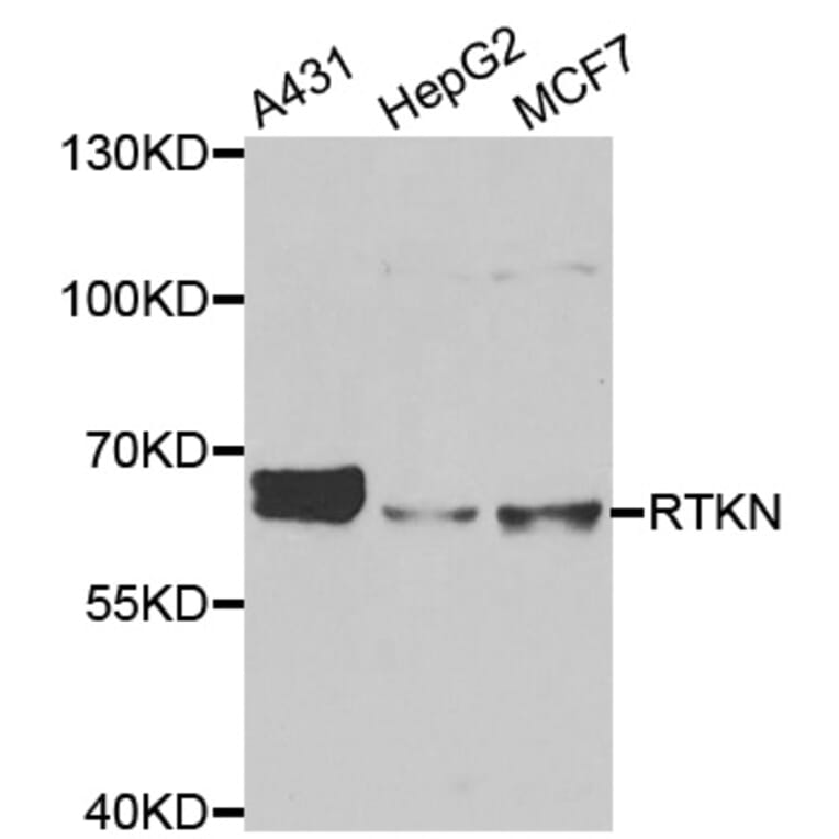Anti-RTKN Antibody from Bioworld Technology (BS8392) - Antibodies.com