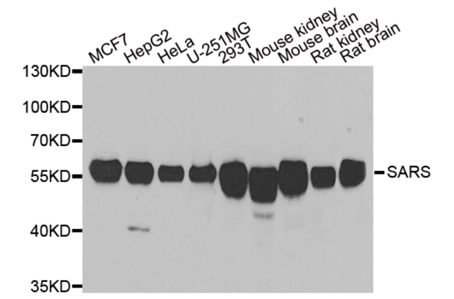 Anti-SARS Antibody from Bioworld Technology (BS8393) - Antibodies.com