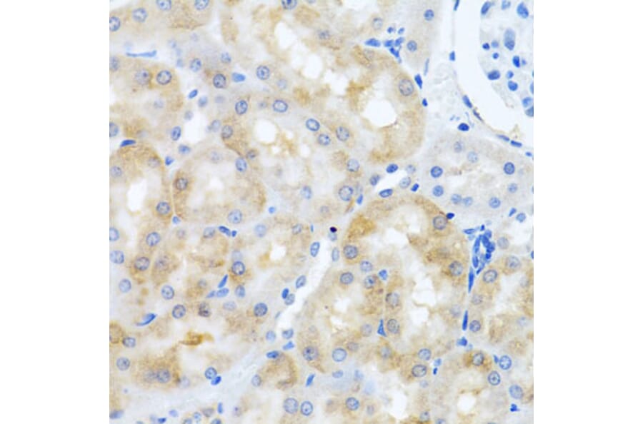 Anti-SCO1 Antibody from Bioworld Technology (BS8394) - Antibodies.com