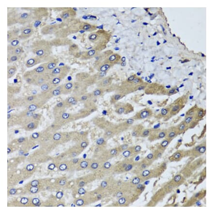 Anti-SCYL1 Antibody from Bioworld Technology (BS8395) - Antibodies.com