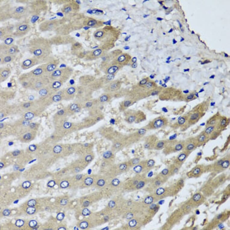Anti-SCYL1 Antibody from Bioworld Technology (BS8395) - Antibodies.com