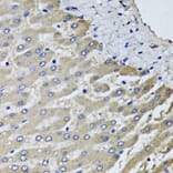 Anti-SCYL1 Antibody from Bioworld Technology (BS8395) - Antibodies.com