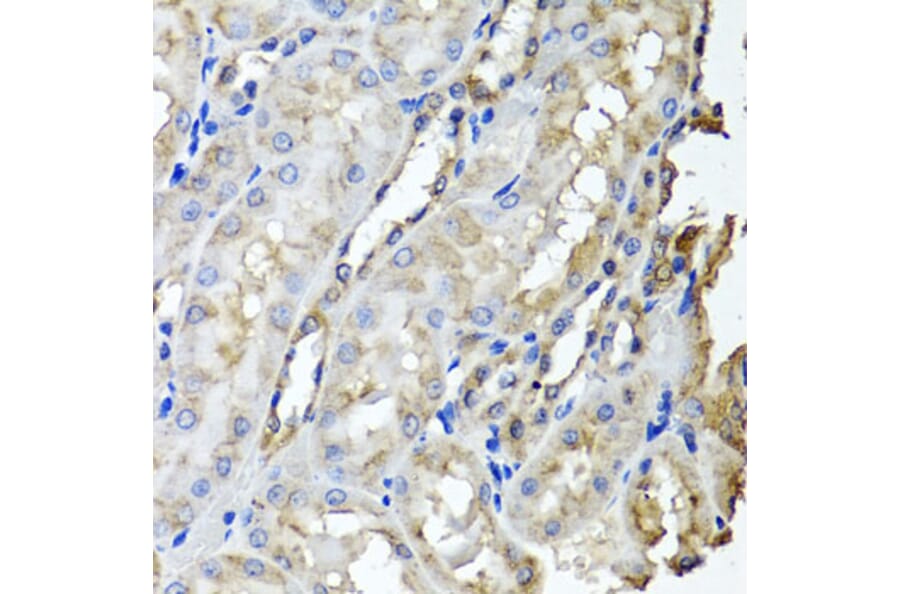 Anti-SCYL1 Antibody from Bioworld Technology (BS8395) - Antibodies.com