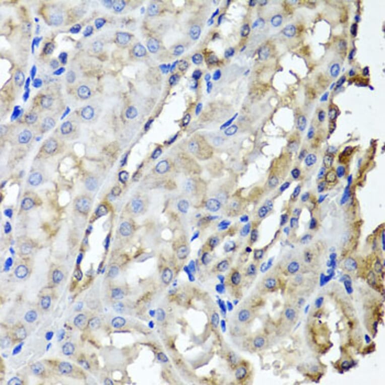 Anti-SCYL1 Antibody from Bioworld Technology (BS8395) - Antibodies.com