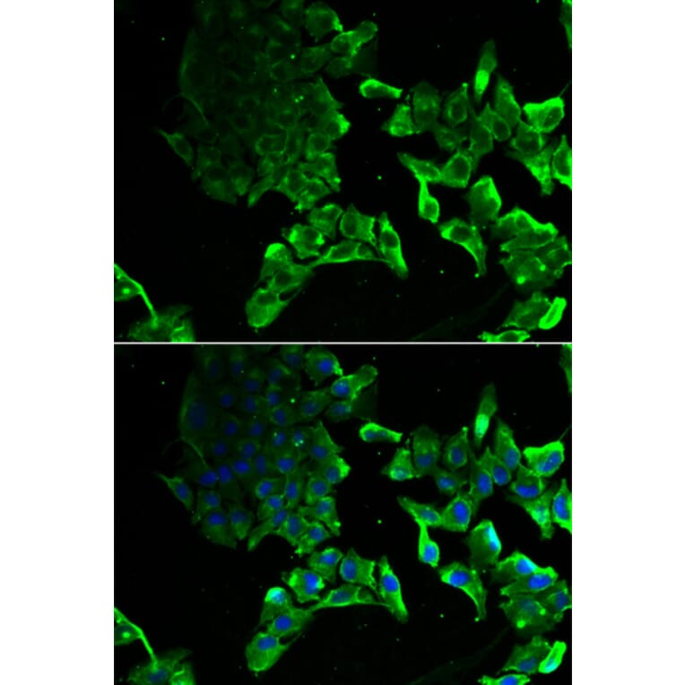Anti-SCYL1 Antibody from Bioworld Technology (BS8395) - Antibodies.com
