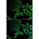 Anti-SCYL1 Antibody from Bioworld Technology (BS8395) - Antibodies.com
