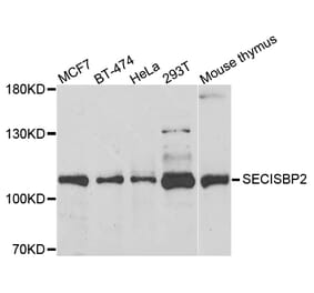 Anti-SECISBP2 Antibody from Bioworld Technology (BS8396) - Antibodies.com