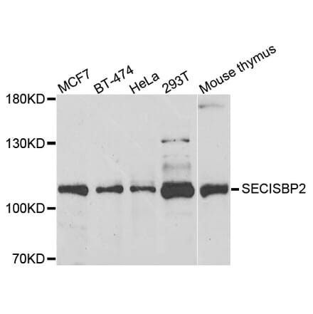 Anti-SECISBP2 Antibody from Bioworld Technology (BS8396) - Antibodies.com