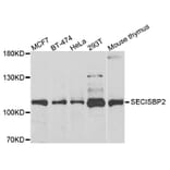 Anti-SECISBP2 Antibody from Bioworld Technology (BS8396) - Antibodies.com