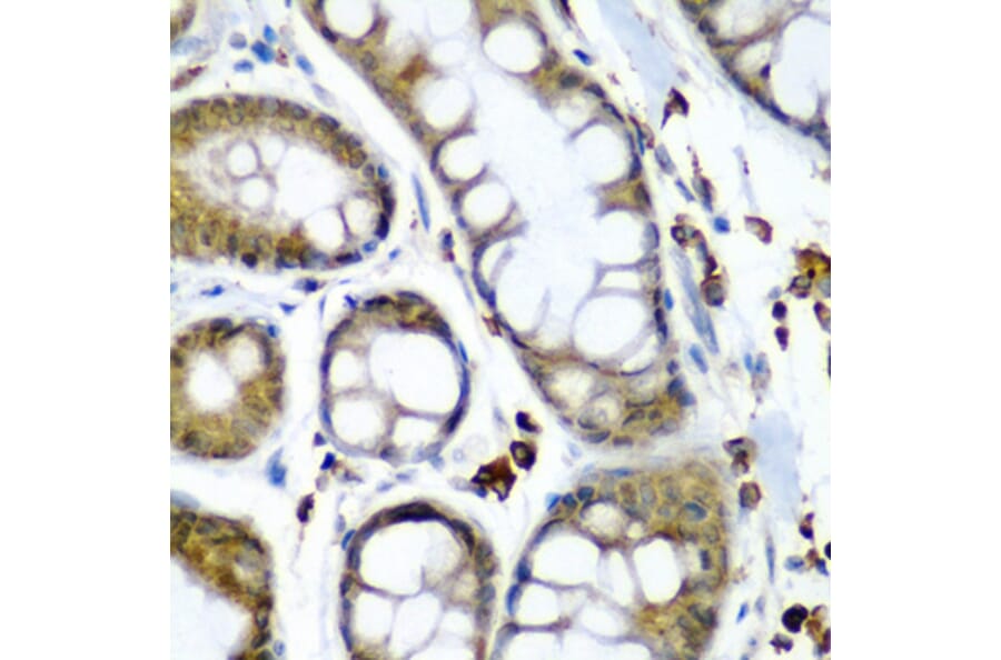 Anti-SECISBP2 Antibody from Bioworld Technology (BS8396) - Antibodies.com
