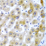 Anti-SECISBP2 Antibody from Bioworld Technology (BS8396) - Antibodies.com