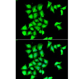 Anti-SEPX1 Antibody from Bioworld Technology (BS8397) - Antibodies.com