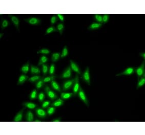 Anti-SETMAR Antibody from Bioworld Technology (BS8398) - Antibodies.com