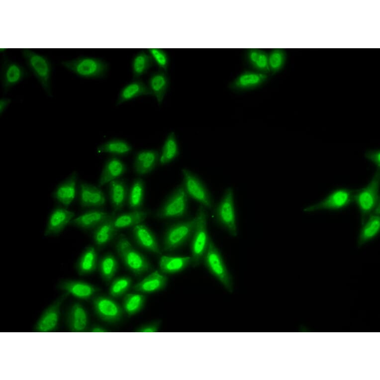 Anti-SETMAR Antibody from Bioworld Technology (BS8398) - Antibodies.com