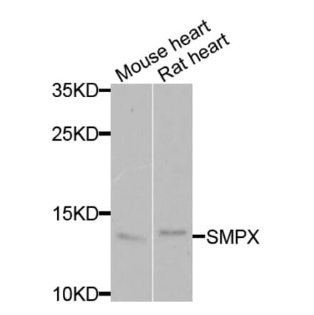 Anti-SMPX Antibody from Bioworld Technology (BS8403) - Antibodies.com