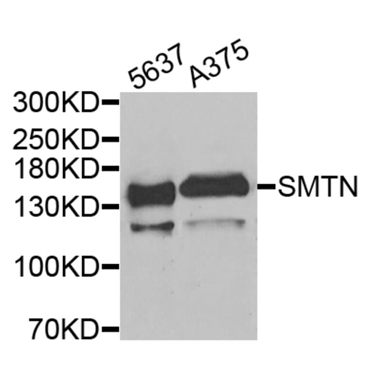 Anti-SMTN Antibody from Bioworld Technology (BS8404) - Antibodies.com