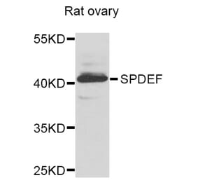 Anti-SPDEF Antibody from Bioworld Technology (BS8406) - Antibodies.com