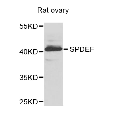 Anti-SPDEF Antibody from Bioworld Technology (BS8406) - Antibodies.com