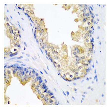 Anti-SPINT2 Antibody from Bioworld Technology (BS8408) - Antibodies.com