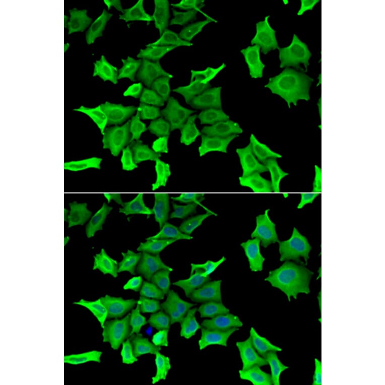 Anti-SPINT2 Antibody from Bioworld Technology (BS8408) - Antibodies.com