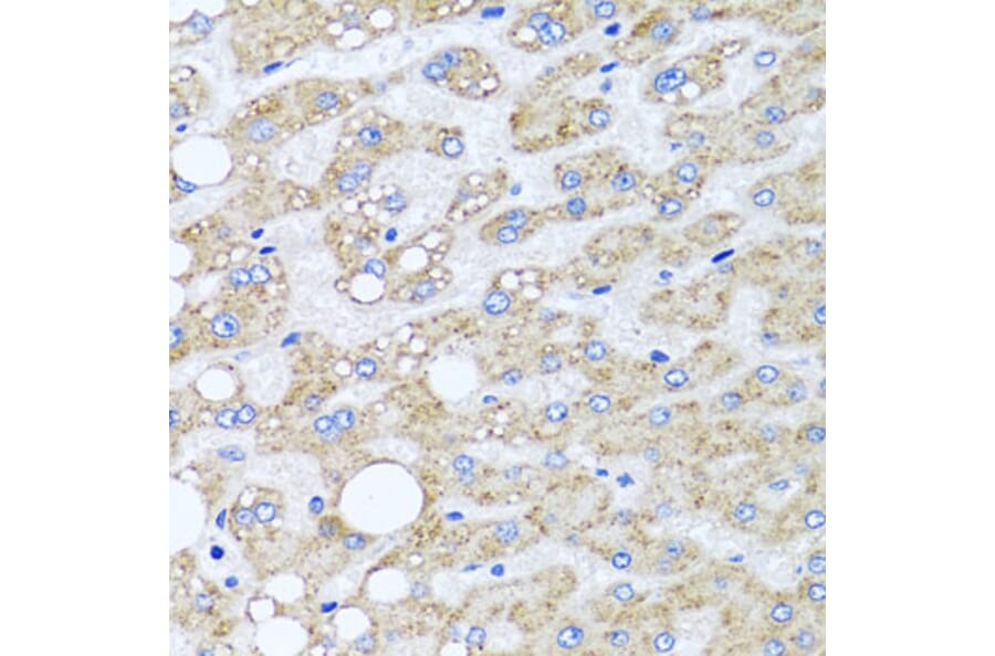 Anti-SRI Antibody from Bioworld Technology (BS8410) - Antibodies.com