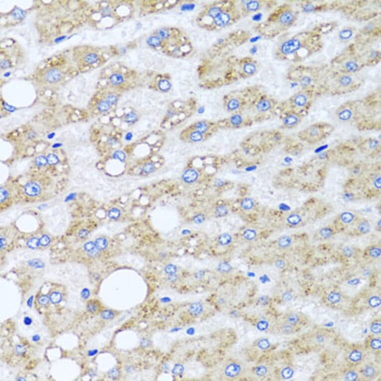 Anti-SRI Antibody from Bioworld Technology (BS8410) - Antibodies.com