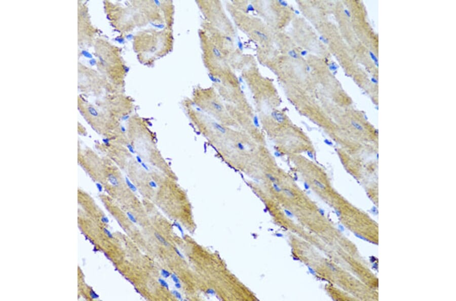 Anti-SRI Antibody from Bioworld Technology (BS8410) - Antibodies.com