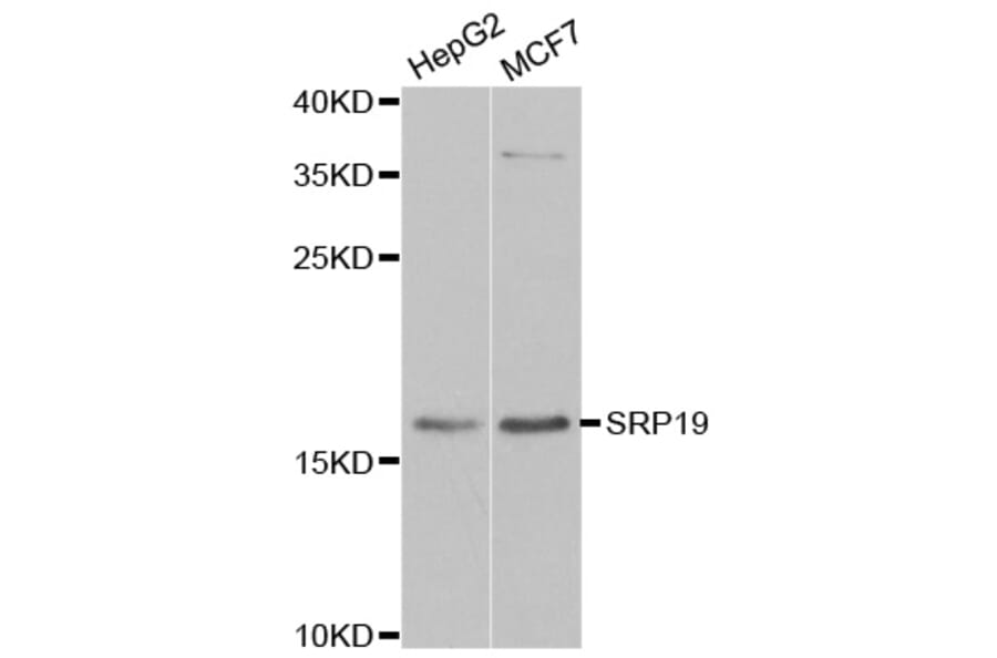 Anti-SRP19 Antibody from Bioworld Technology (BS8411) - Antibodies.com