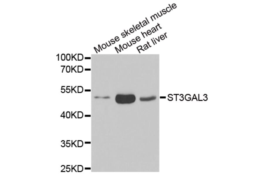 Anti-ST3GAL3 Antibody from Bioworld Technology (BS8412) - Antibodies.com
