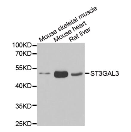 Anti-ST3GAL3 Antibody from Bioworld Technology (BS8412) - Antibodies.com