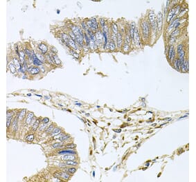 Anti-STRN3 Antibody from Bioworld Technology (BS8415) - Antibodies.com