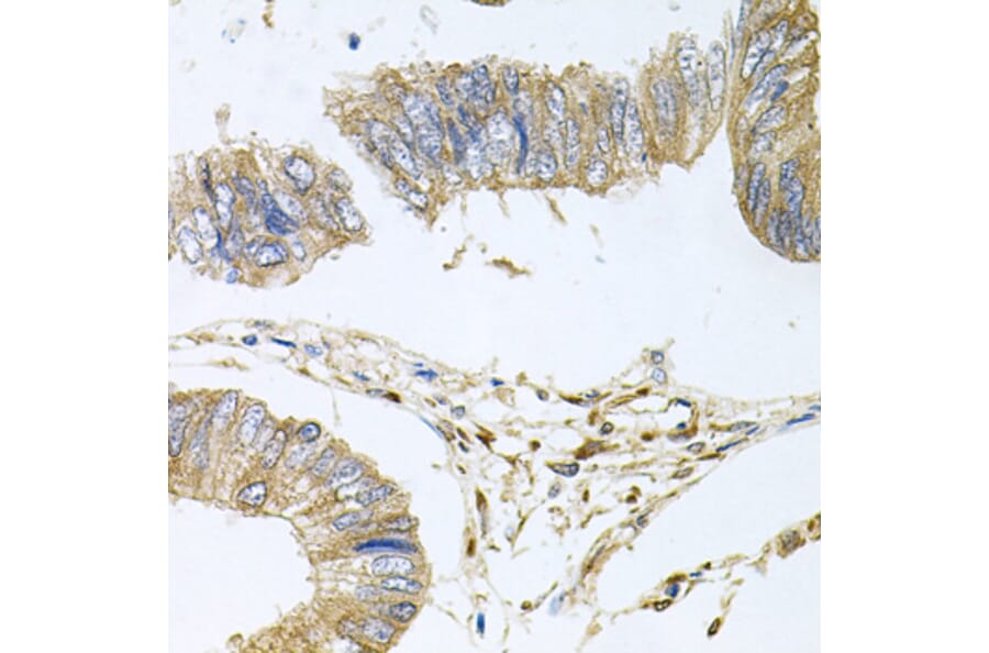 Anti-STRN3 Antibody from Bioworld Technology (BS8415) - Antibodies.com