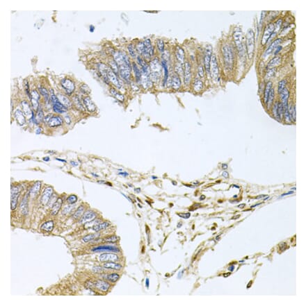Anti-STRN3 Antibody from Bioworld Technology (BS8415) - Antibodies.com