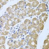 Anti-STRN3 Antibody from Bioworld Technology (BS8415) - Antibodies.com