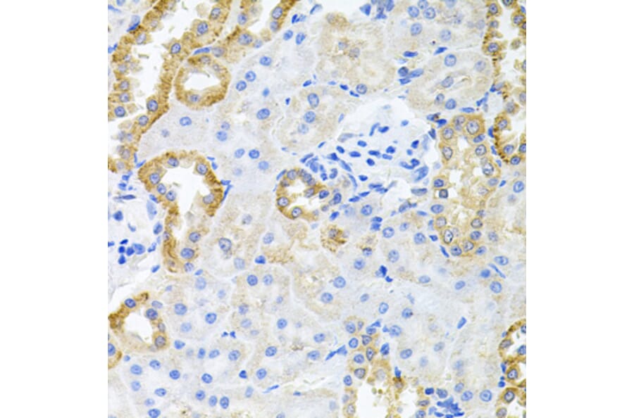 Anti-STRN3 Antibody from Bioworld Technology (BS8415) - Antibodies.com