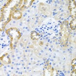 Anti-STRN3 Antibody from Bioworld Technology (BS8415) - Antibodies.com