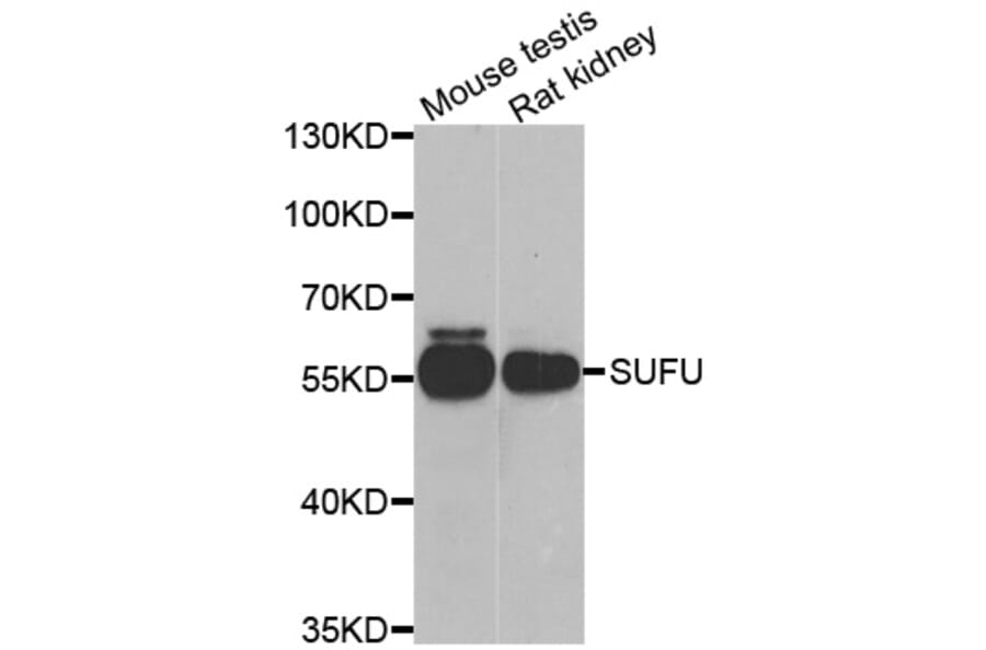 Anti-SUFU Antibody from Bioworld Technology (BS8416) - Antibodies.com