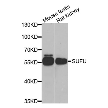 Anti-SUFU Antibody from Bioworld Technology (BS8416) - Antibodies.com