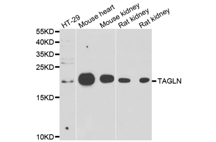 Anti-TAGLN Antibody from Bioworld Technology (BS8418) - Antibodies.com