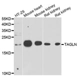 Anti-TAGLN Antibody from Bioworld Technology (BS8418) - Antibodies.com