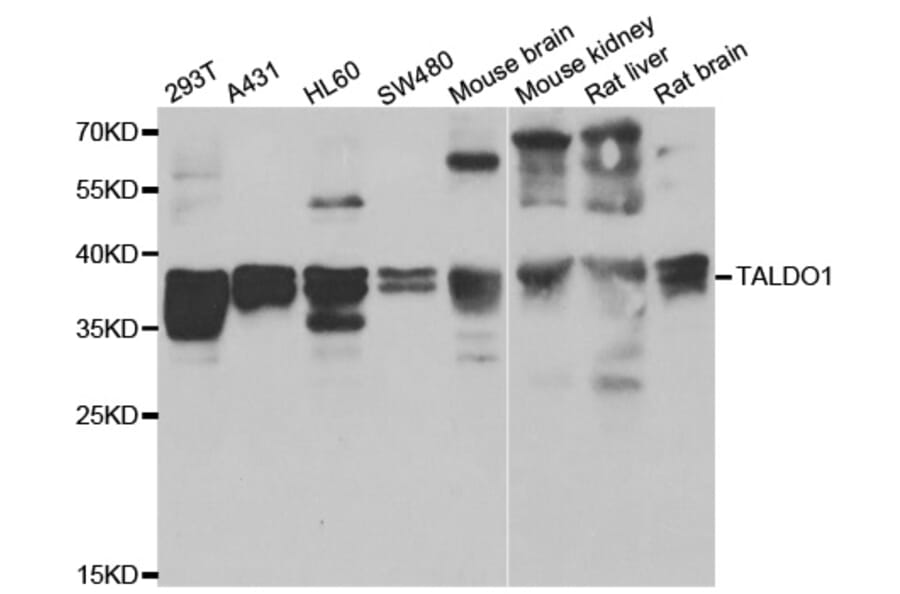 Anti-TALDO1 Antibody from Bioworld Technology (BS8420) - Antibodies.com