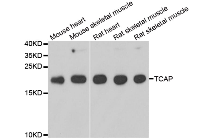 Anti-TCAP Antibody from Bioworld Technology (BS8422) - Antibodies.com