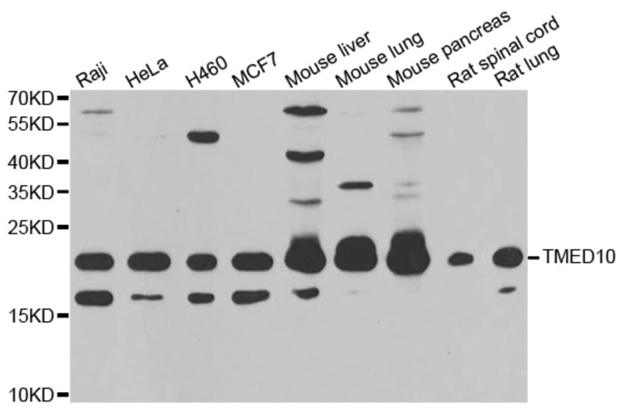 Anti-TMED10 Antibody from Bioworld Technology (BS8426) - Antibodies.com