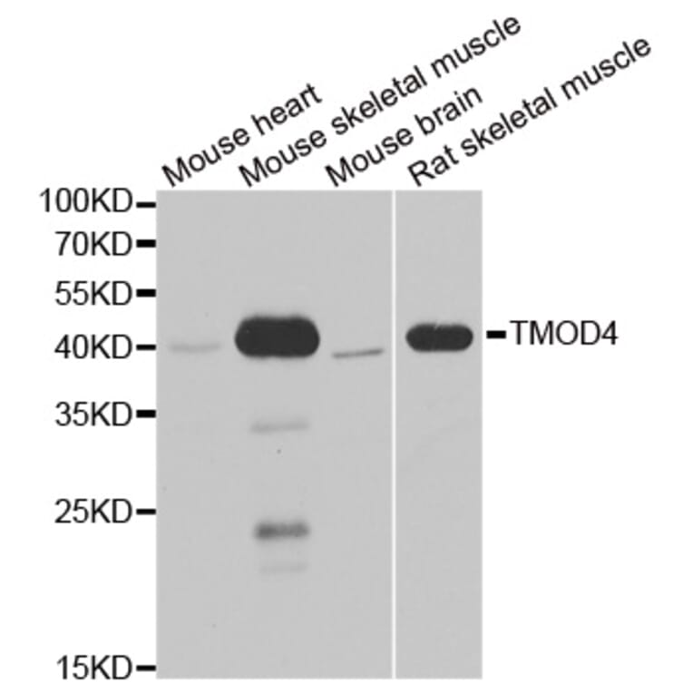 Anti-TMOD4 Antibody from Bioworld Technology (BS8427) - Antibodies.com