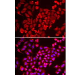 Anti-TNP2 Antibody from Bioworld Technology (BS8428) - Antibodies.com