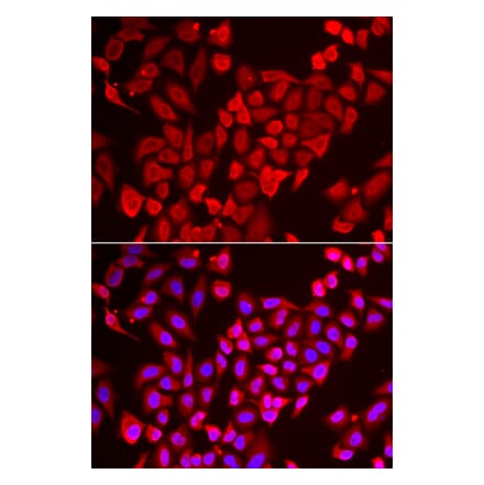 Anti-TNP2 Antibody from Bioworld Technology (BS8428) - Antibodies.com