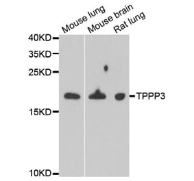 Anti-TPPP3 Antibody from Bioworld Technology (BS8429) - Antibodies.com