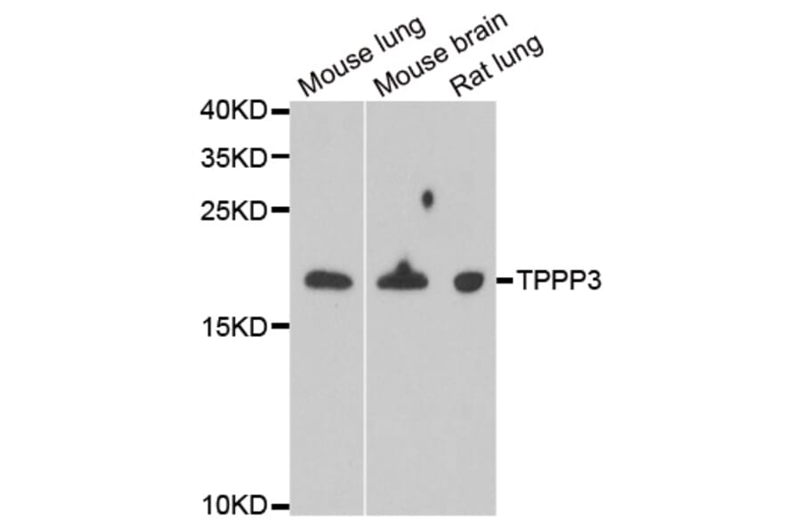 Anti-TPPP3 Antibody from Bioworld Technology (BS8429) - Antibodies.com