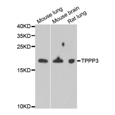 Anti-TPPP3 Antibody from Bioworld Technology (BS8429) - Antibodies.com